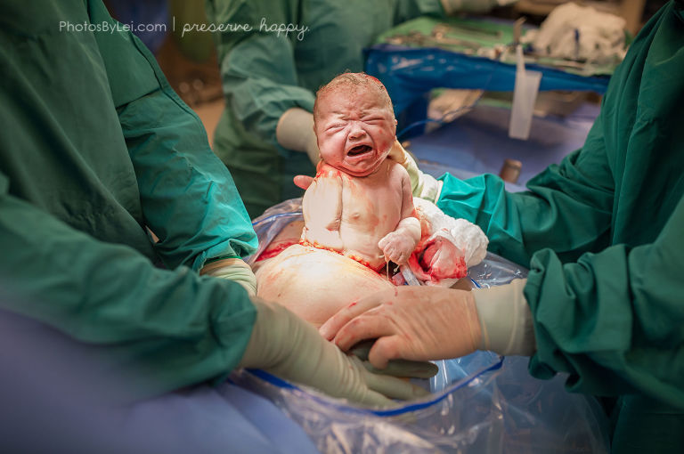 gallery-1453853906-3-c-section